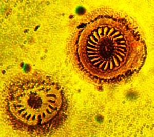 Trichodinella epizootica